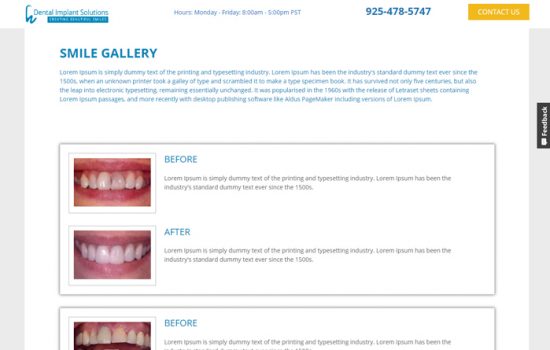 dental-implant2